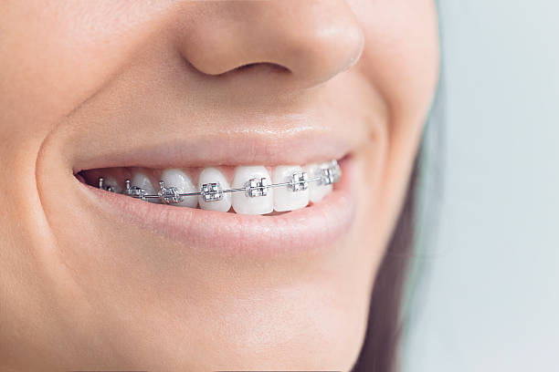 Best Veneers and Lumineers  in Scottsbluff, NE